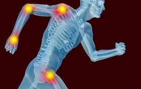 Przyczyny rozwoju arthrotes i artrozy