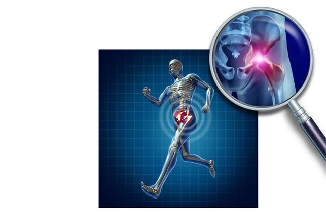 Ból podczas biegania w stawie biodrowym